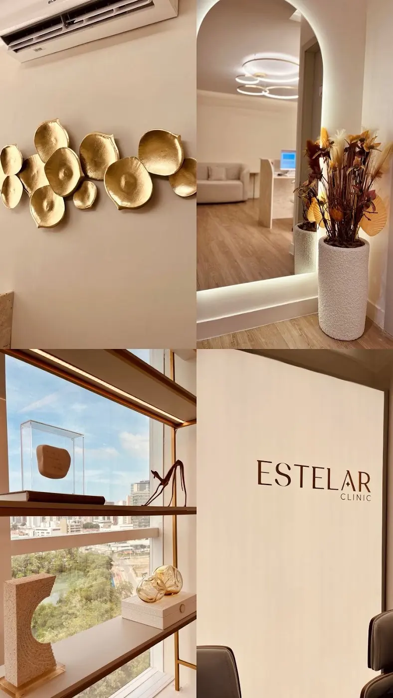 Detalhes dourados e a marca Estelar na parede