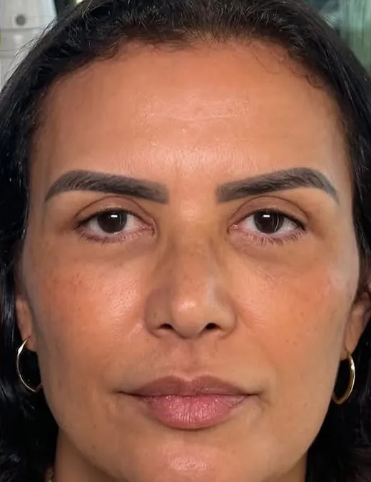Depois do rejuvenescimento